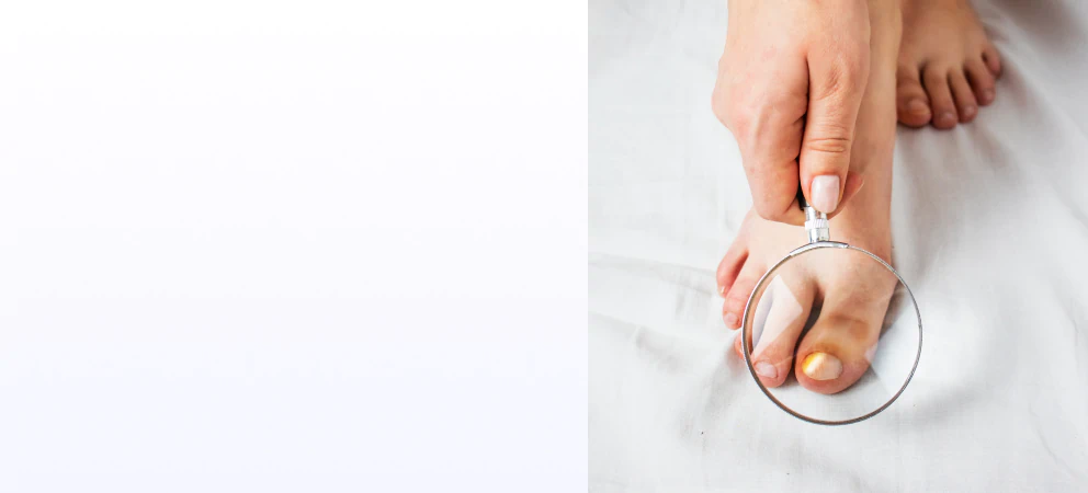 Unhealthy toenail visual