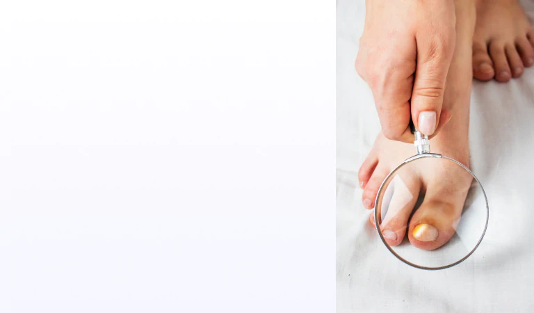 Unhealthy toenail visual
