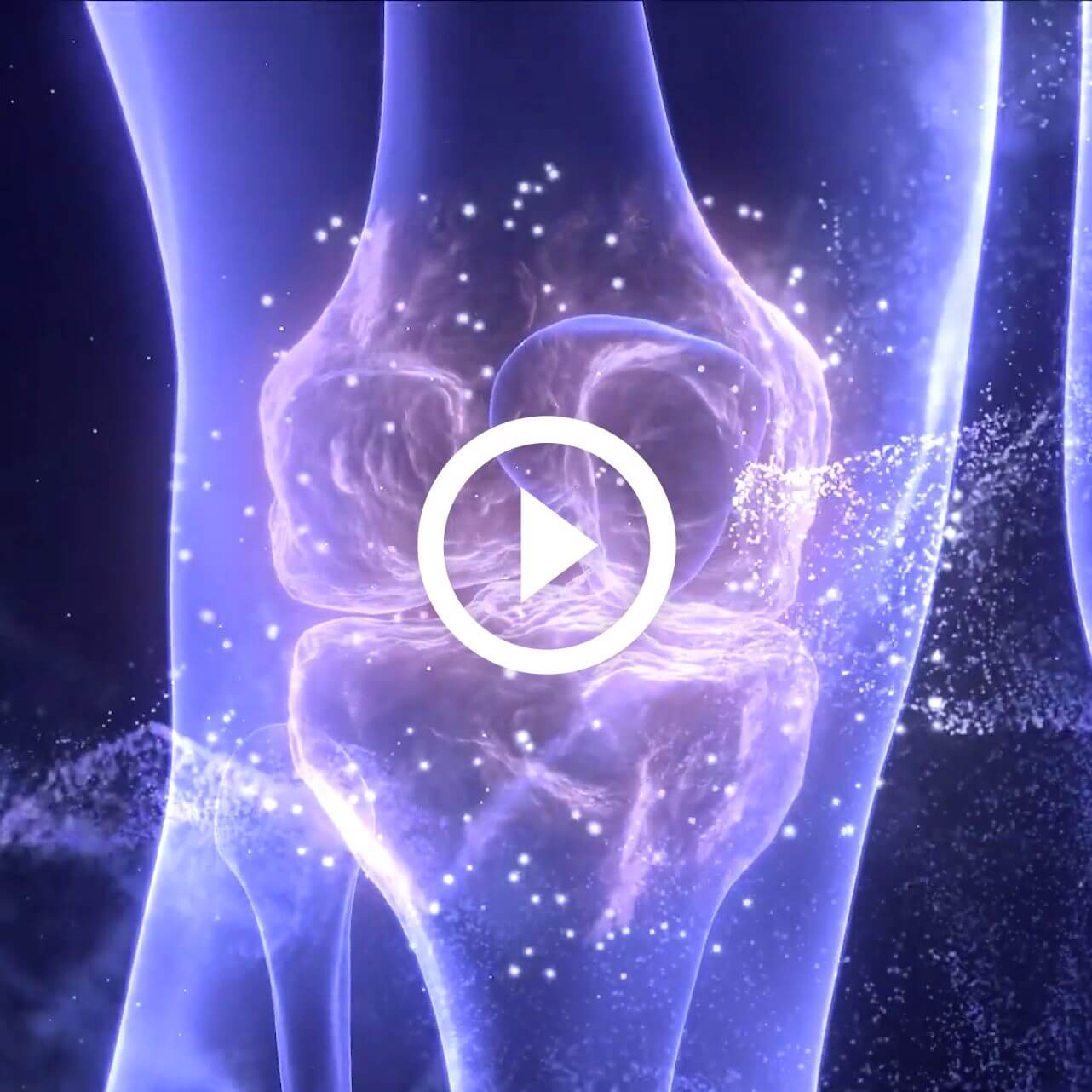 Joint Complex